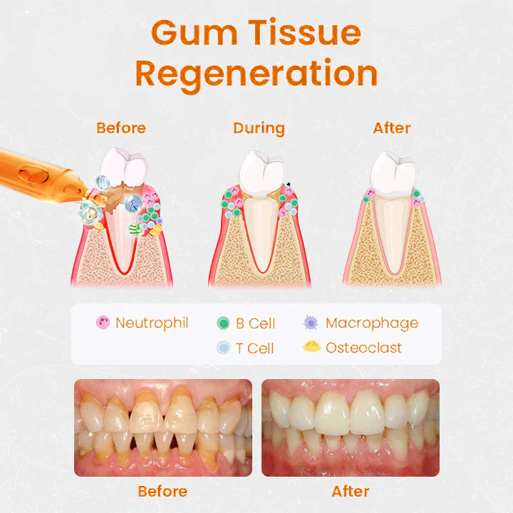 👑👑Fiole de tratament Cvreoz® pentru repararea gingiilor