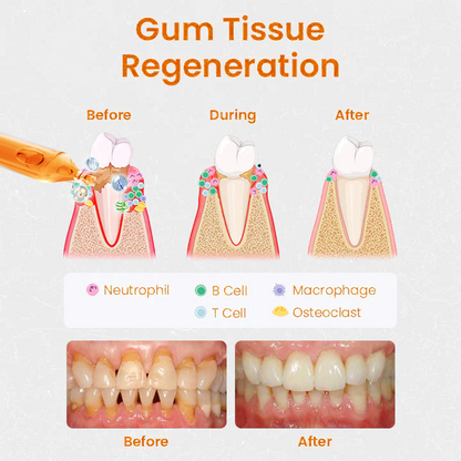 👑👑Fiole de tratament Cvreoz® pentru repararea gingiilor