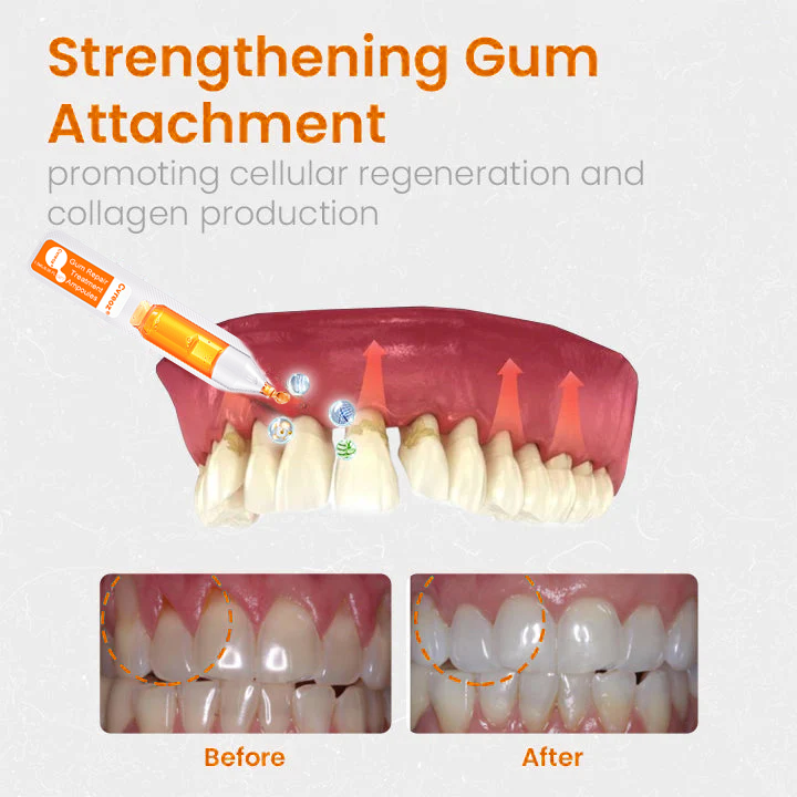 👑👑Fiole de tratament Cvreoz® pentru repararea gingiilor