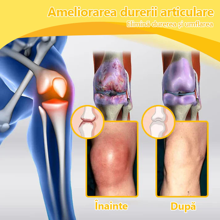 🍀🍀ArthroFree™ Cremă pentru dureri osoase cu venin de albine🐝(În special pentru adulții în vârstă și recomandat de AAOS) x