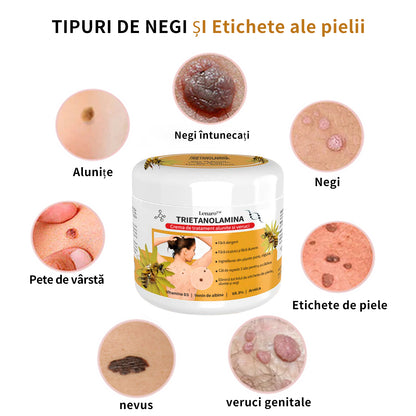 🎉🎉🎉[✨ Magazin Oficial Al Mărcii✨] Lenaro™ Venin de albine Venin de albine Cremă pentru tratarea alunițelor și negilor(👨‍⚕AAD RECOMANDĂ)