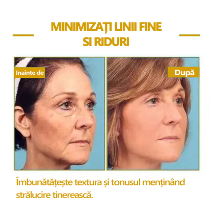 👑🔥Reducere pentru ultima zi: 70% REDUCERE🔥 Fubsta® Ulei de întinerire SkinFirming