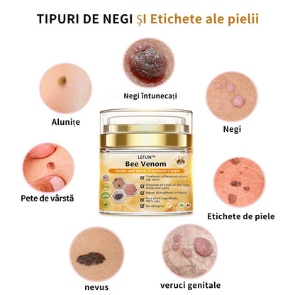 [👑Magazinul oficial al mărcii👑] LEFUN™ Cremă cu venin de albine pentru tratarea alunițelor și verucilor(👨‍⚕AAD RECOMANDĂ)4