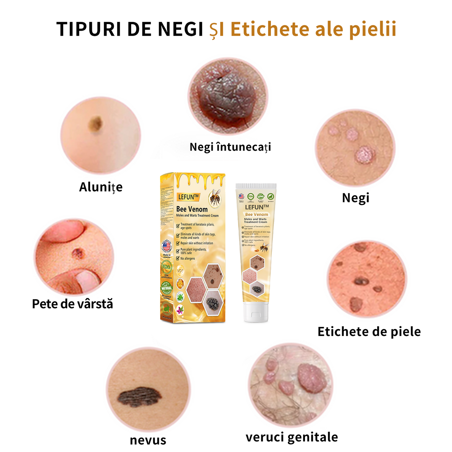 🌈🌈🧴🧴[👑Magazinul oficial al mărcii👑] LEFUN™ Cremă pentru tratamentul alunițelor și negilor cu venin de albine ( 👨 ⚕AAD RECOMANDAT)