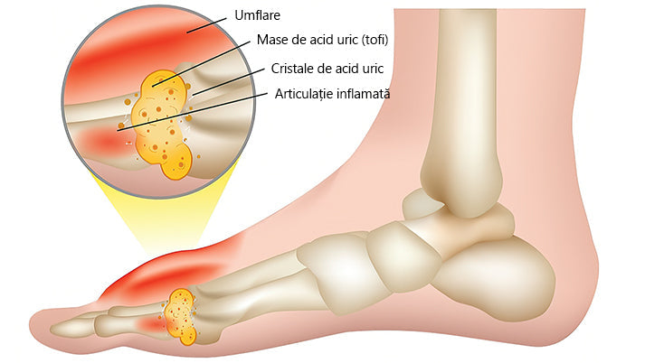 🍀🍀ArthroFree™ Cremă pentru dureri osoase cu venin de albine🐝(În special pentru adulții în vârstă și recomandat de AAOS) x