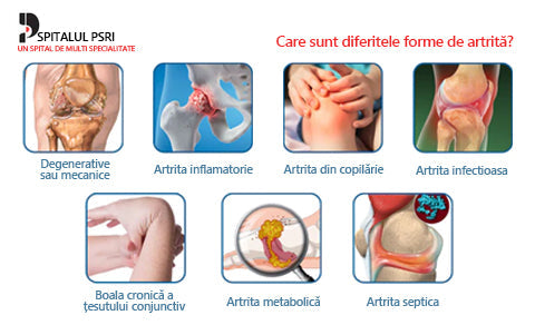 🍀🍀ArthroFree™ Cremă pentru dureri osoase cu venin de albine🐝(În special pentru adulții în vârstă și recomandat de AAOS) x