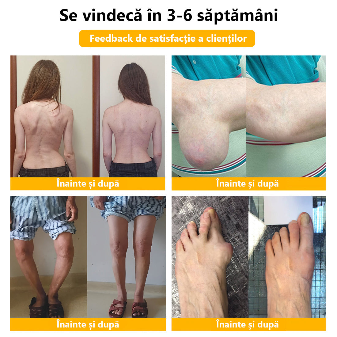 🍀🍀ArthroFree™ Cremă pentru dureri osoase cu venin de albine🐝(În special pentru adulții în vârstă și recomandat de AAOS) x