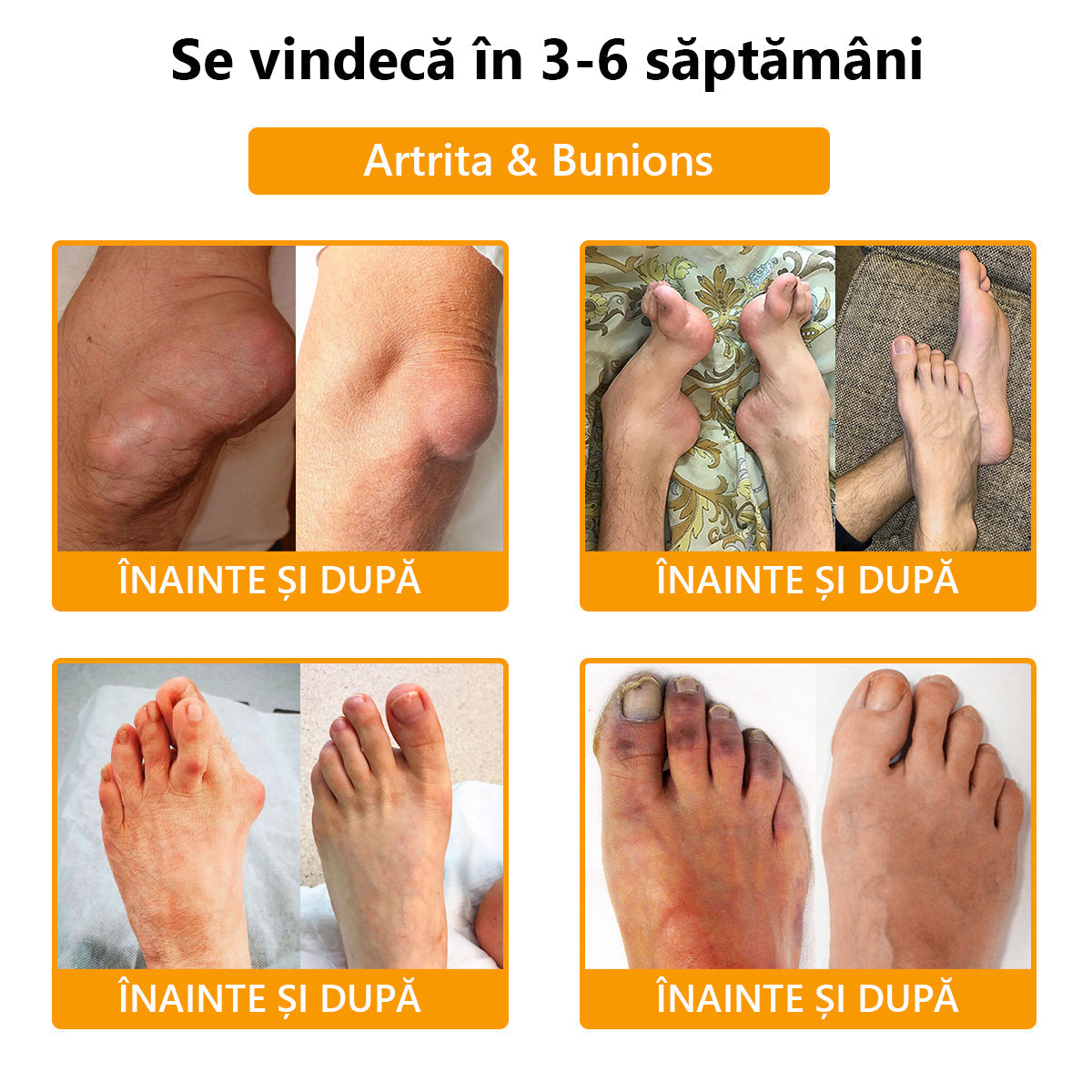 🍀🍀ArthroFree™ Cremă pentru dureri osoase cu venin de albine🐝(În special pentru adulții în vârstă și recomandat de AAOS) x