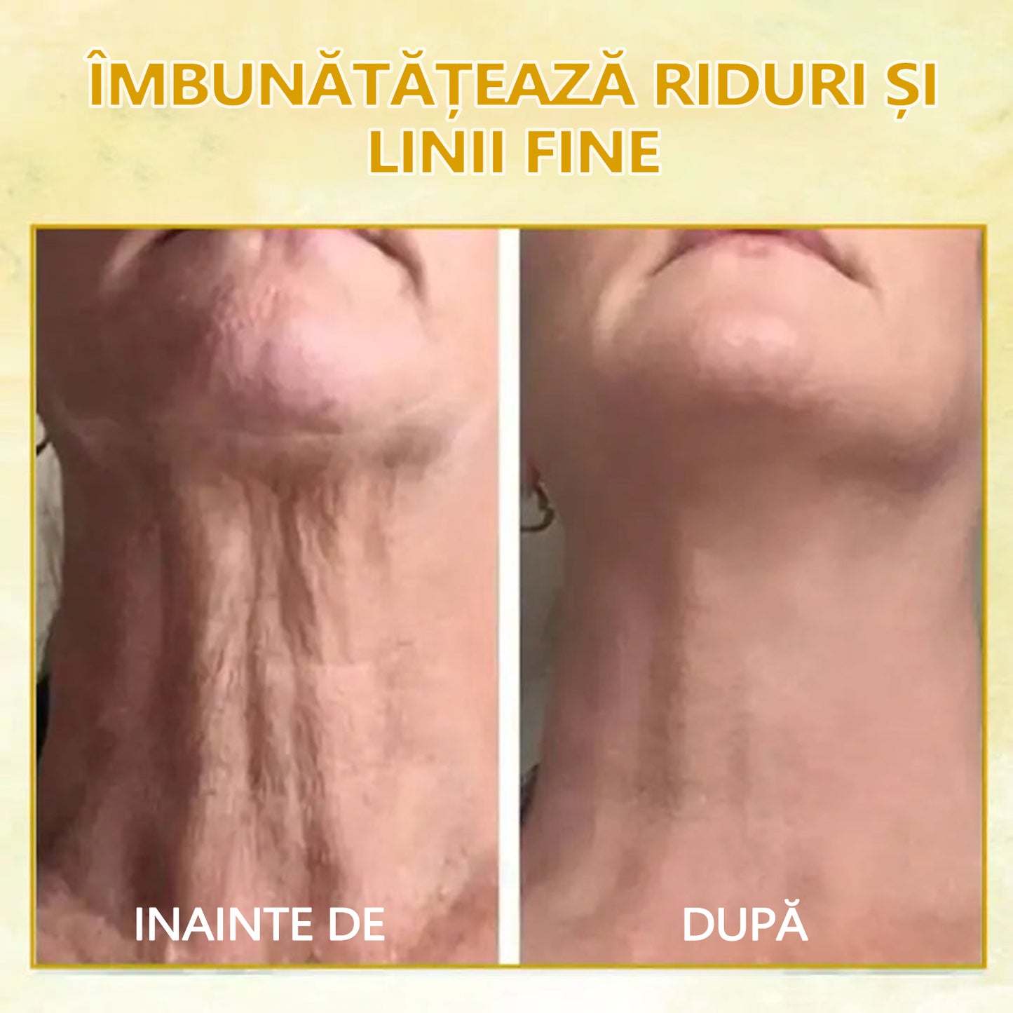 🍀🍀Reducere ultima zi: 70% 0FF 🐝LEFUN® Ulei pentru fermitate și întinerire x