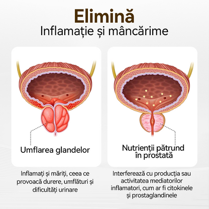 Spuneți adio disconfortului de prostată🛡️ Lenaro™ ProstaVibe Honey Delay Inhaler💪