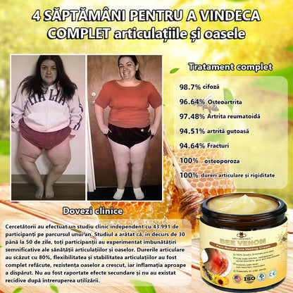 🍀🍀ArthroFree™ Cremă pentru dureri osoase cu venin de albine🐝(În special pentru adulții în vârstă și recomandat de AAOS) x