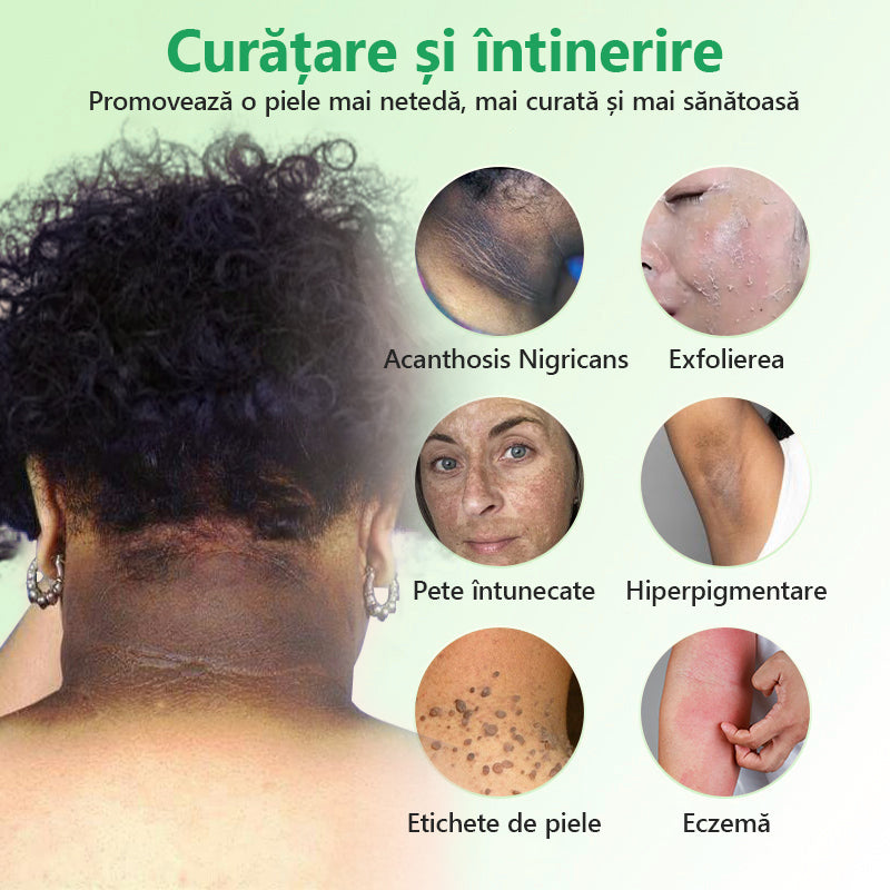 Gel exfoliant purificator pentru Acanthosis Nigricans, exfoliere, pete întunecate, etichete cutanate și eczeme x💖💖