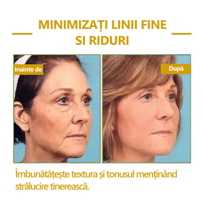 🍀🍀Reducere ultima zi: 70% 0FF 🐝LEFUN® Ulei pentru fermitate și întinerire x