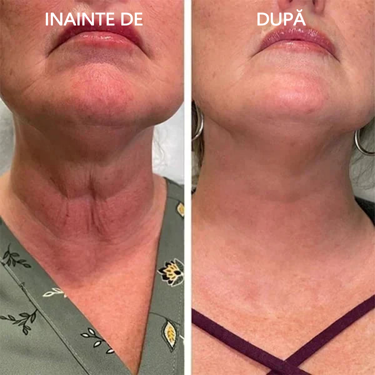 👑🔥Reducere pentru ultima zi: 70% REDUCERE🔥 Fubsta® Ulei de întinerire SkinFirming