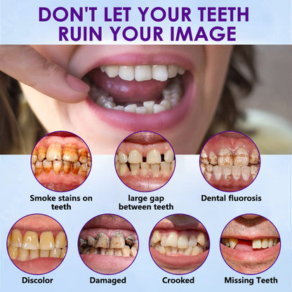 𝐵𝑖𝑘𝑒𝑛𝑑𝑎™ Set de Regle Dentare din Silicon 🧨🧨 (👩‍🔬Conform cu CED, Aprobat de Stomatologi Profesioniști)