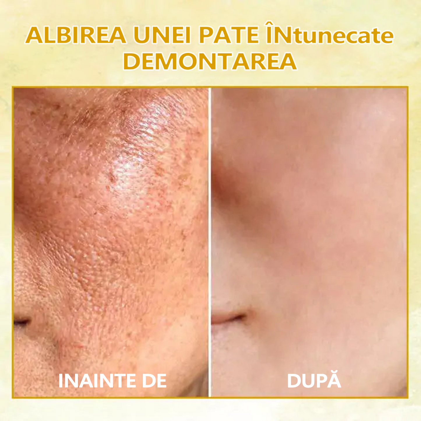 👑🔥Reducere pentru ultima zi: 70% REDUCERE🔥 Fubsta® Ulei de întinerire SkinFirming