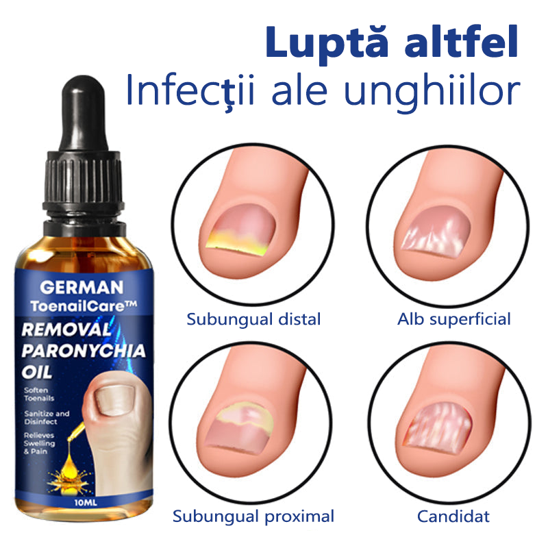 🔥🔥Ulei german ToenaCare™ îndepărtarea Paronychia🔥(Reducere limitată de timp durează 30 de minute) lmny