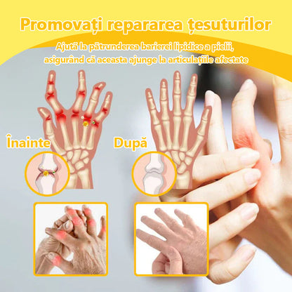 🍀🍀ArthroFree™ Cremă pentru dureri osoase cu venin de albine🐝(În special pentru adulții în vârstă și recomandat de AAOS) x